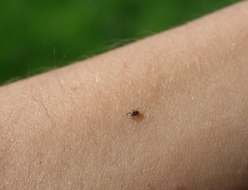 Lyme Disease: How it Can Affect Your Health