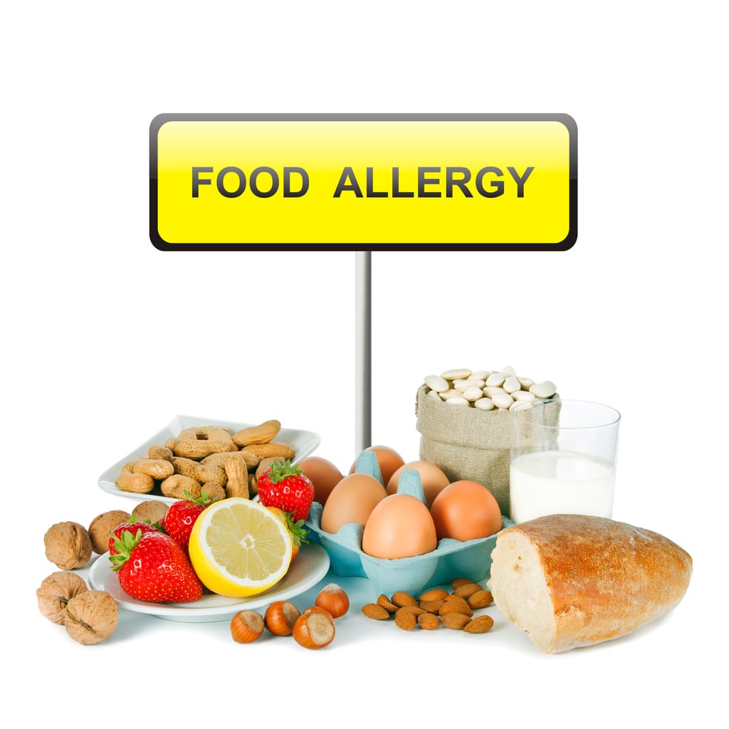 FOod Allergy SIgn w Food common food allergies