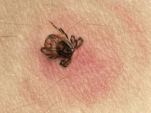 How To Protect From Lyme Disease This Summer