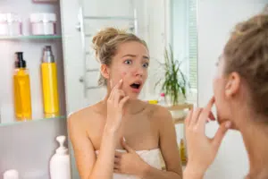 foods that cause acne Atlanta Ga
