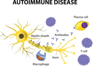 Autoimmune Disease Atlanta Ga