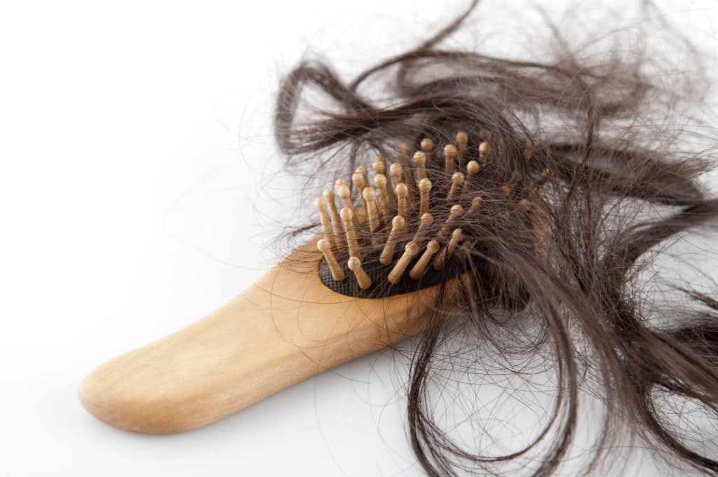 hair loss in women Atlanta Ga