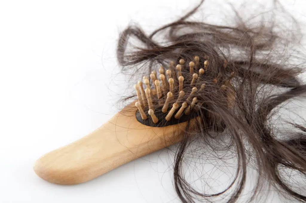 hair loss in women Atlanta Ga