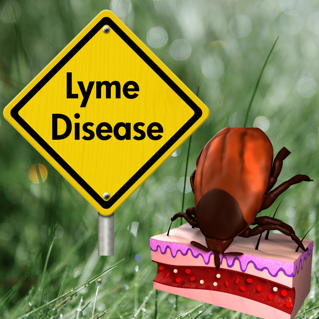 how serious is lyme disease