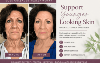 boost collagen naturally